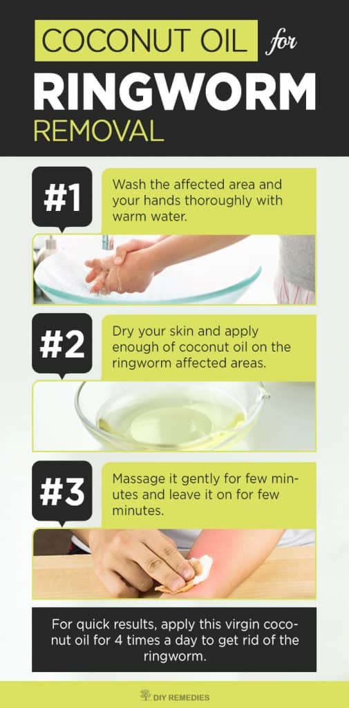 How to use Coconut Oil for Ringworm Removal