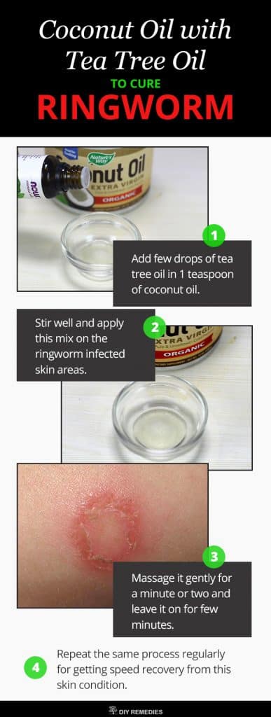 Coconut Oil with Tea Tree Oil For RingWorm