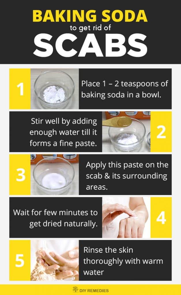 Baking Soda Remedies For Scabs