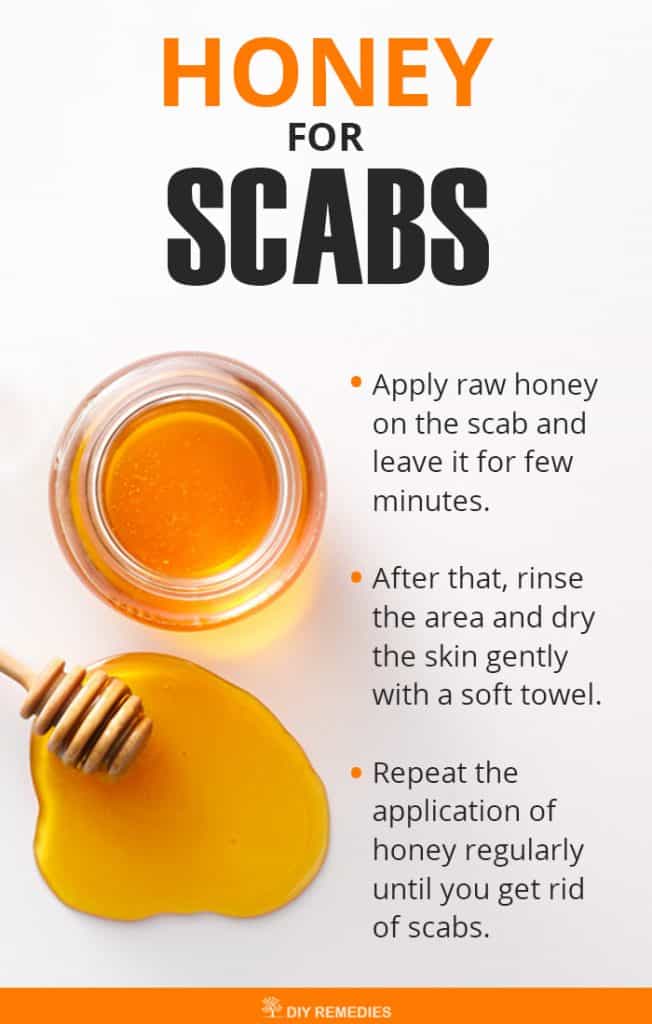 Honey Remedies for Baking Soda Remedies For Scabs