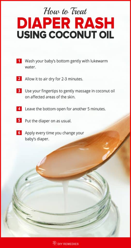 Coconut Oil for Diaper Rash