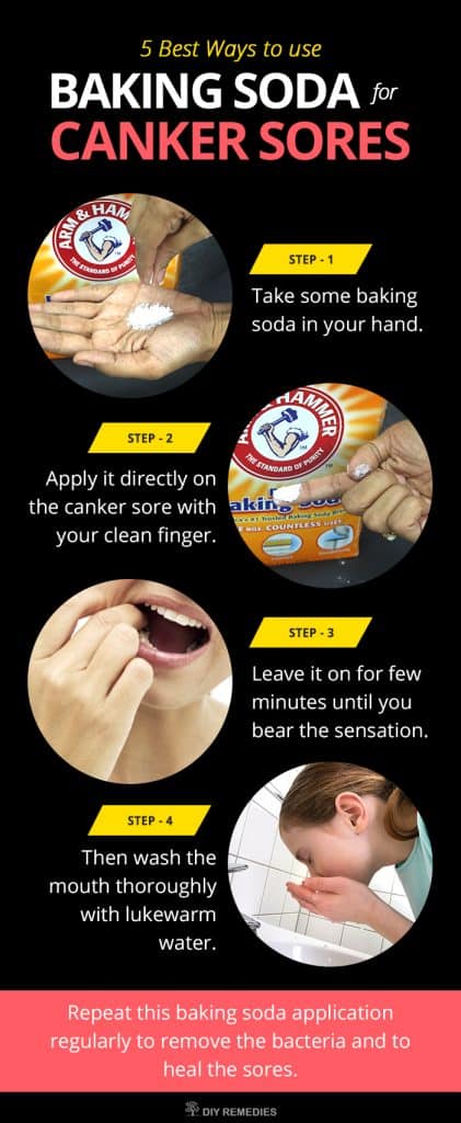 How Baking Soda Cures Canker Sores