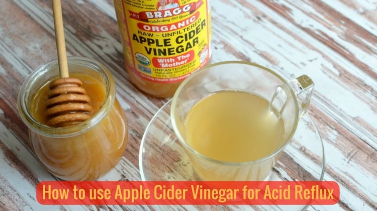 How to Treat Acid Reflux using Apple Cider Vinegar