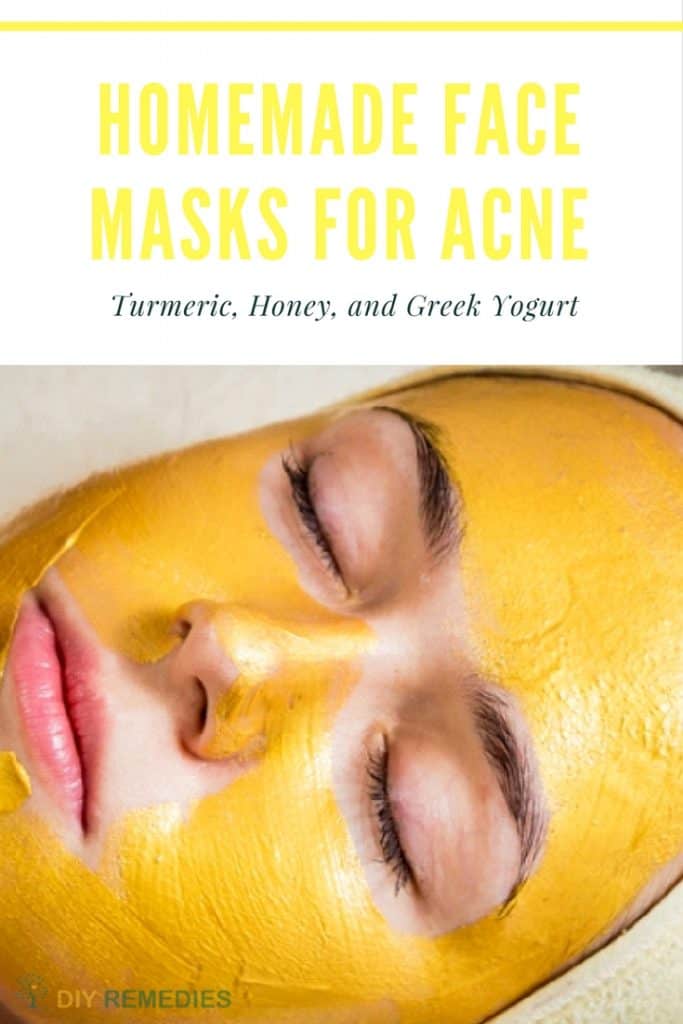 Turmeric Face Masks for Acne
