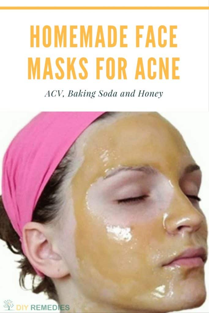 ACV Face Masks for Acne