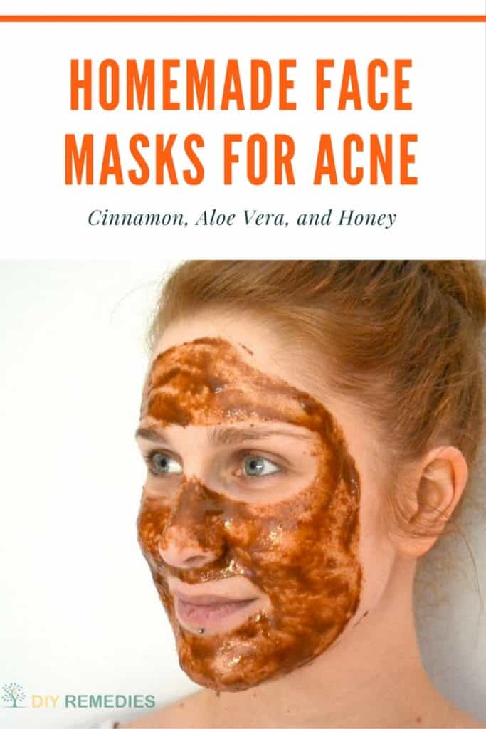 Cinnamon Face Masks for Acne