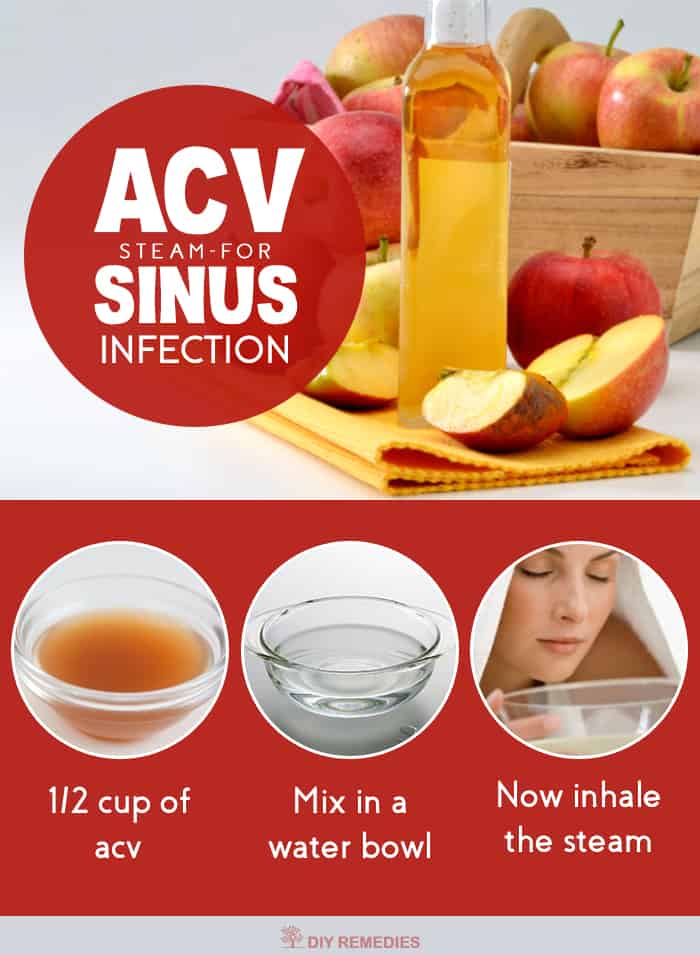 How-to-Clear-Sinus-Infection-with-Apple-Cider-Vinegar