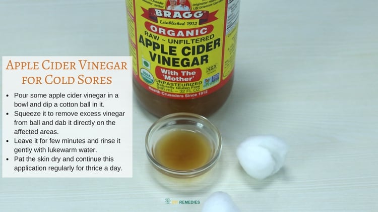DIY Apple Cider Vinegar for Cold Sores