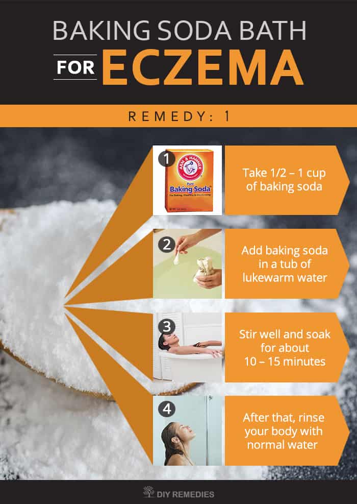 How-to-Soothe-Eczema-with-Baking-Soda