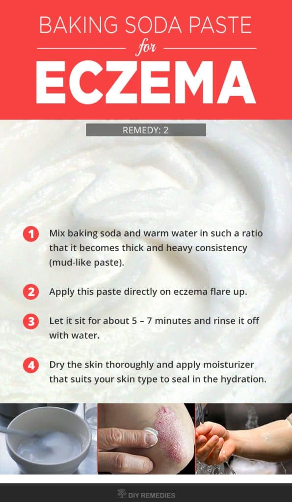 Baking Soda Paste for Eczema
