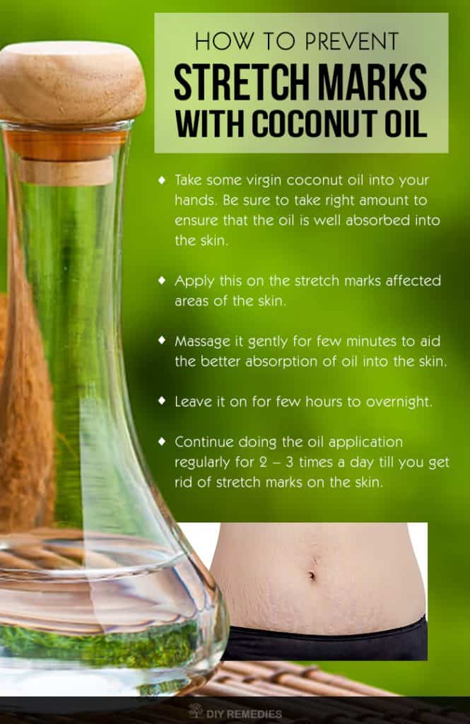 How to use Coconut Oil for Stretch Marks