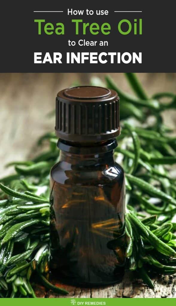 How to Treat Ear Infection using Tea Tree Oil