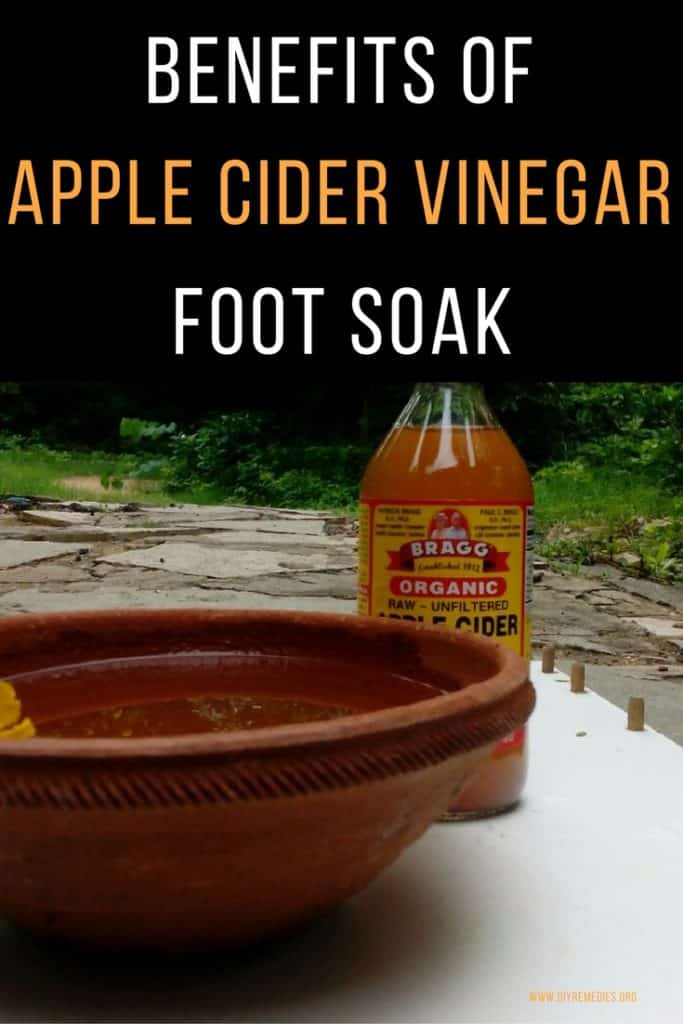 Apple Cider Vinegar Soaks for Feet