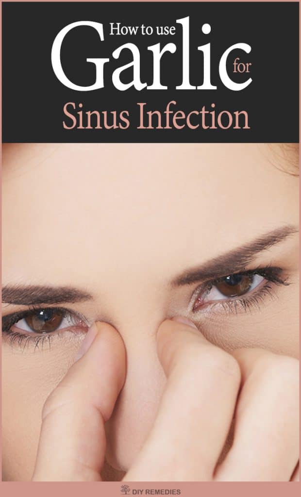 How to Treat Sinus Infection using Garlic