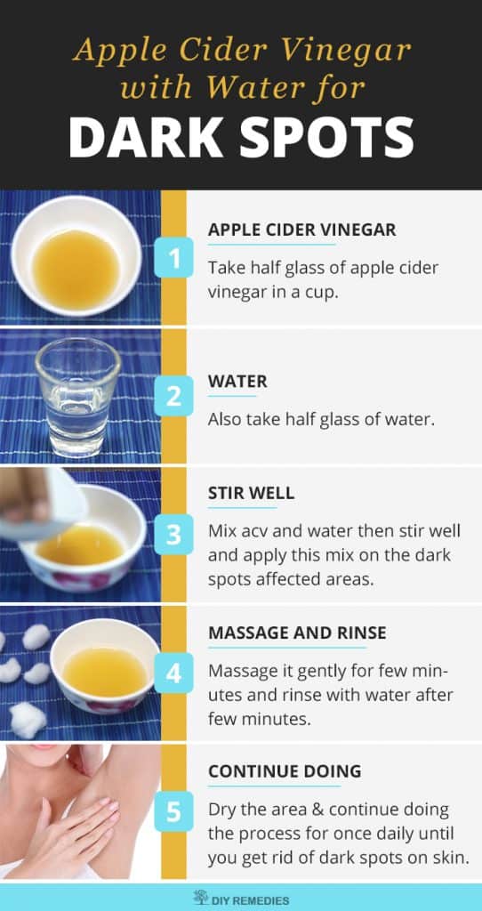 Apple Cider Vinegar and Water for Dark Spots