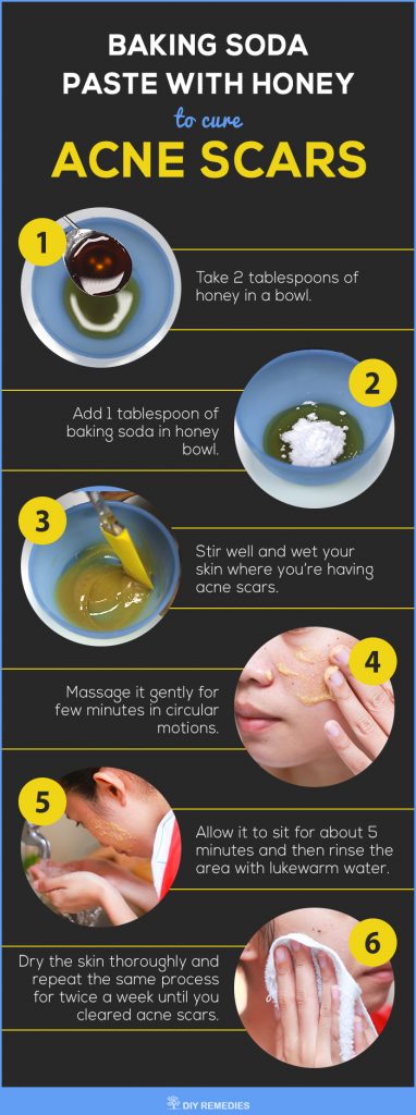 Baking Soda with Honey Paste for ACNE Scars