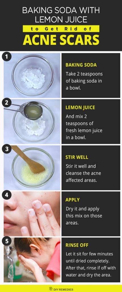 Baking Soda with Lemon Juice For Acne Scars