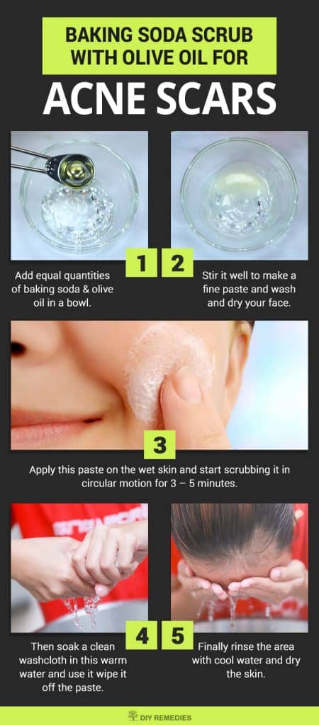 Baking Soda Scrub with Olive Oil For Baking Soda with Lemon Juice For Acne Scars