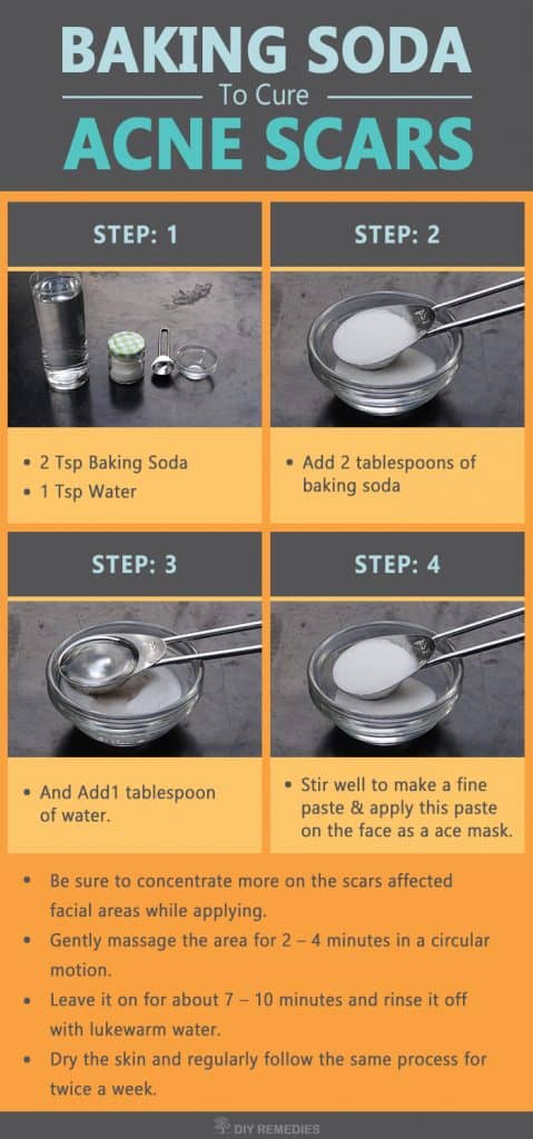 How-to-Get-Rid-of-Acne-Scars-using-Baking-Soda