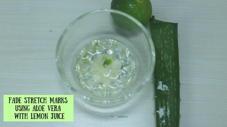 How Aloe Vera Reduces Stretch Marks