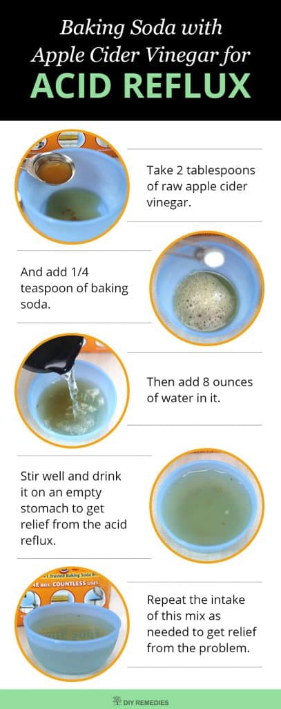 Baking Soda with Apple Cider Vinegar For Acid Reflux