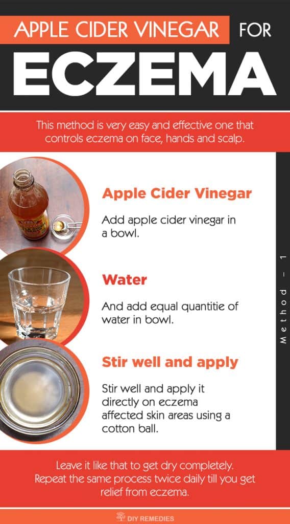 Apple Cider Vinegar for Eczema
