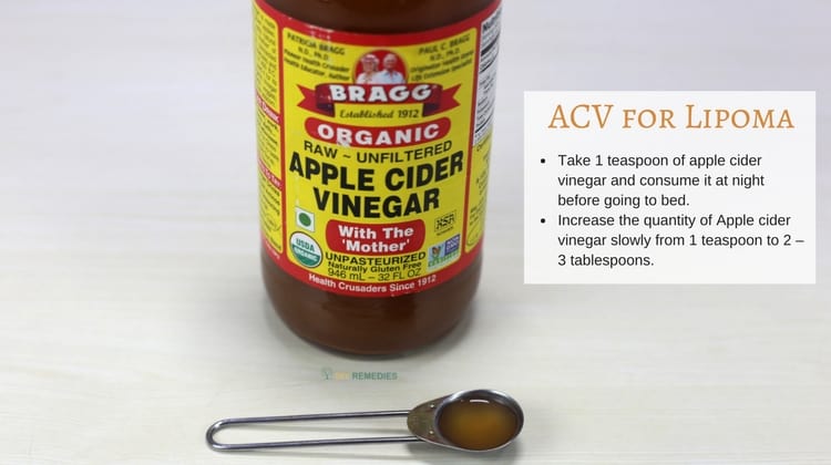 How to Cure Lipoma using Apple Cider Vinegar