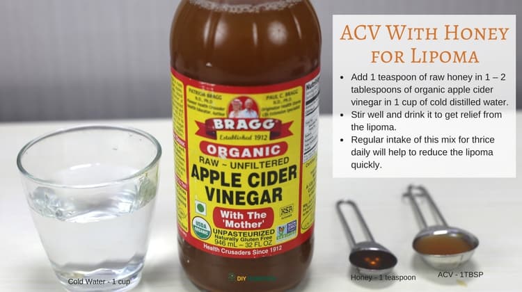 How to Cure Lipoma using Apple Cider Vinegar