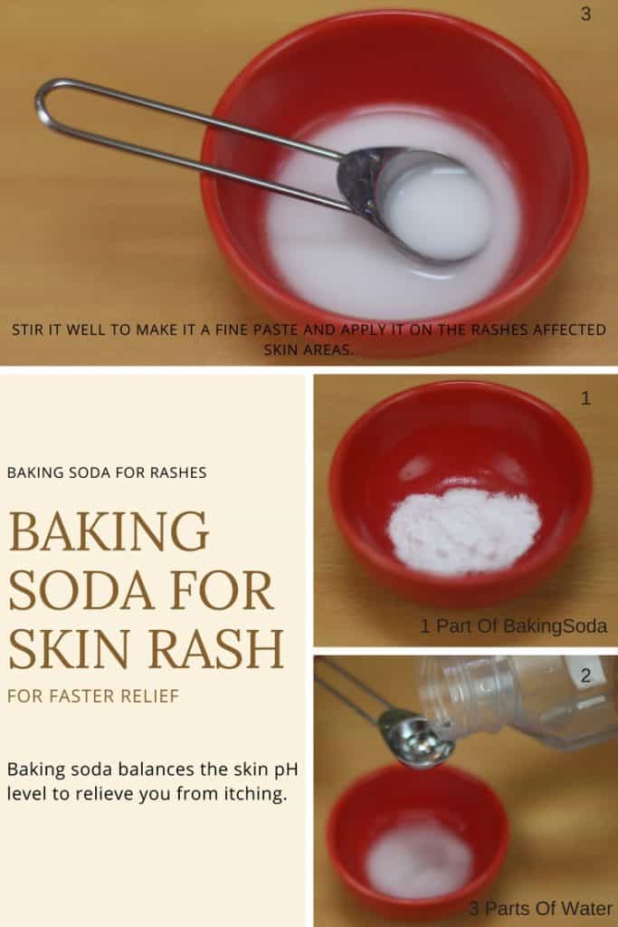 Baking Soda for Skin Rash