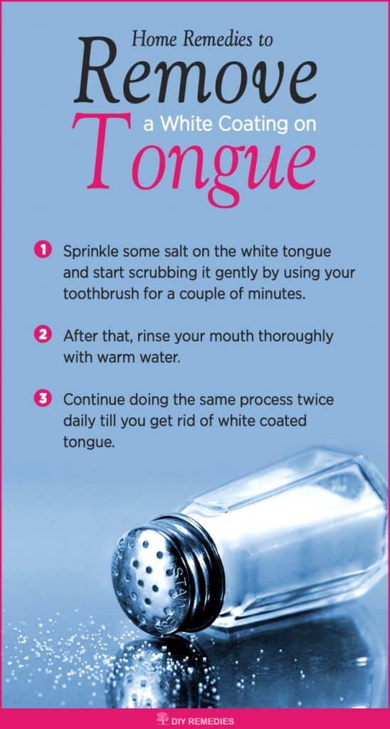 Home Remedies to Remove a White Coating on Tongue