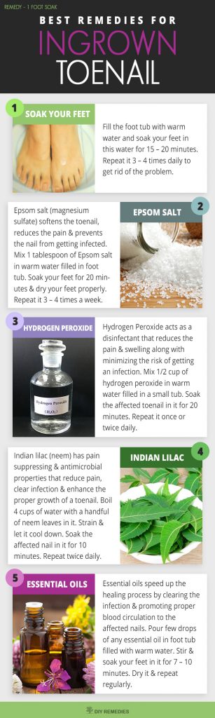 Foot Soak Remedies for Ingrown Toenails