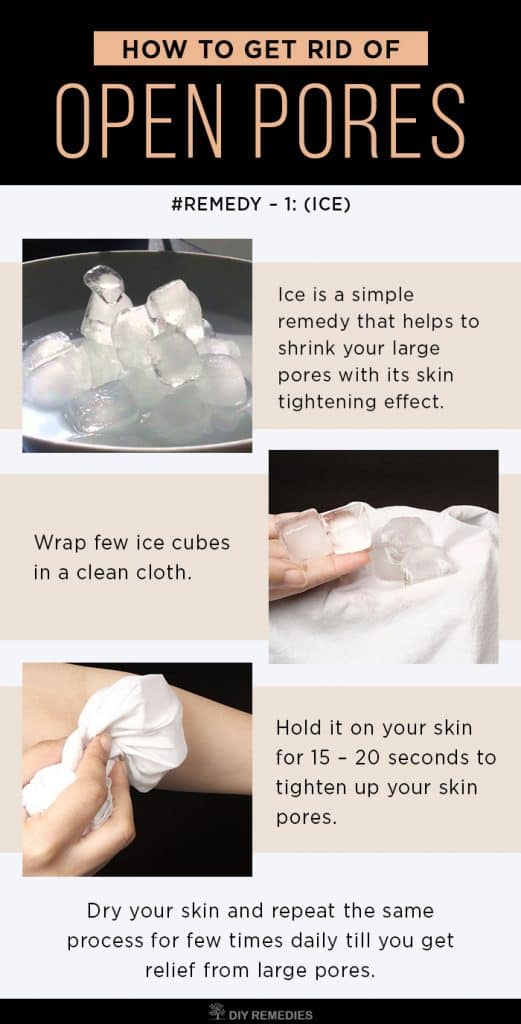 ICE Remedies for Open Pores