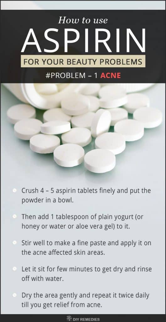 Aspirin for Acne
