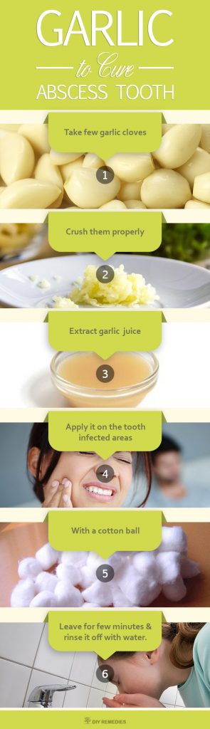 Natural-Remedies-to-Cure-Abscess-Tooth