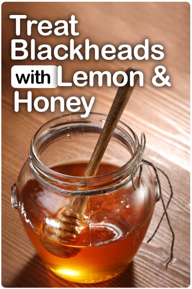 How Honey used to Remove Blackheads