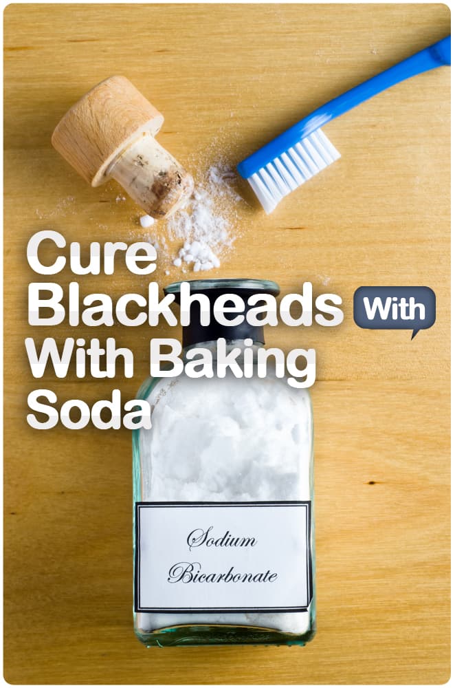 Blackheads with Baking Soda