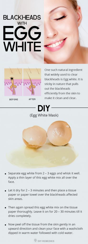 How to Get Rid of Blackheads with Egg White