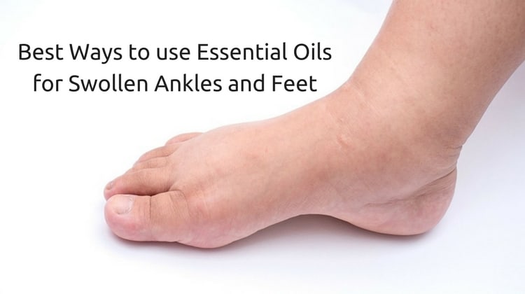 Best Ways to use Essential Oils for Swollen Ankles and Feet