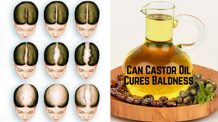Can Castor Oil Cures Baldness?