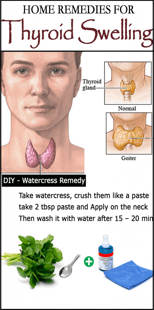 DIY Home Remedies For Goiter