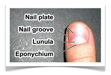 Nail Care Remove Nails Loodie