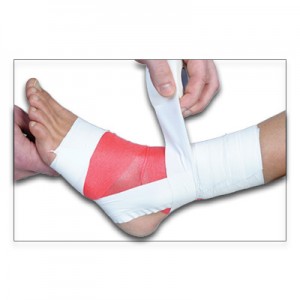 Treating injuries in the kitchen