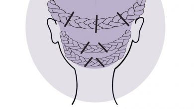 braids to prepare for the wig