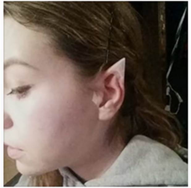 7-How-Makeup-Goblin-Ears-With Ice