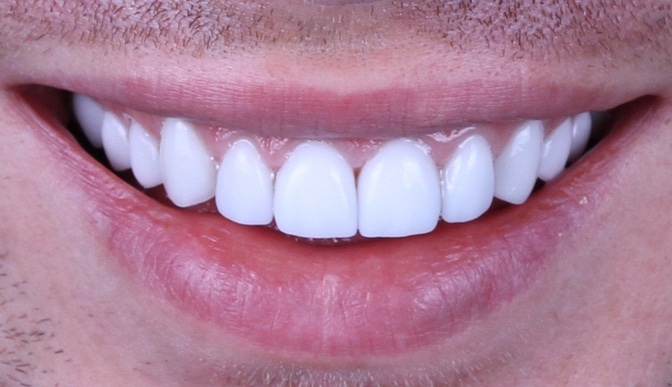 dental fluoroscopy to make teeth look bigger