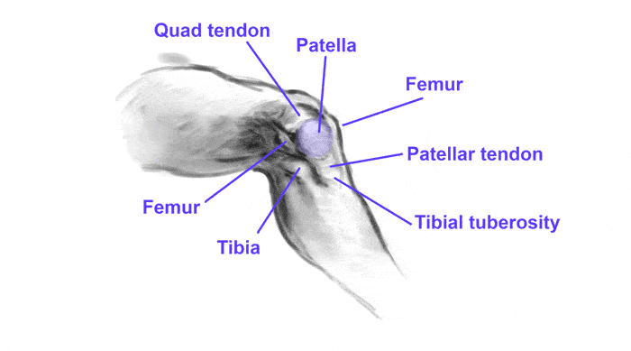 bent epicondyles visible