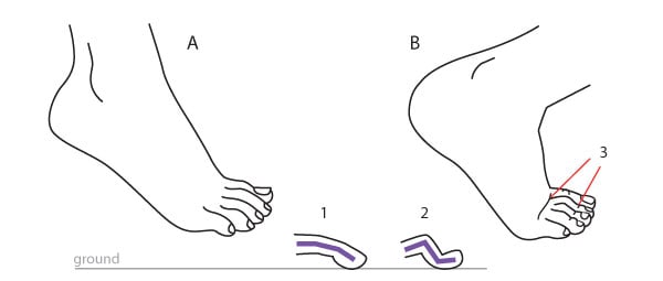 Details of the foot seen frontally