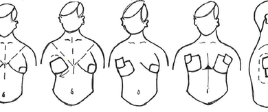 chest pics 1 large